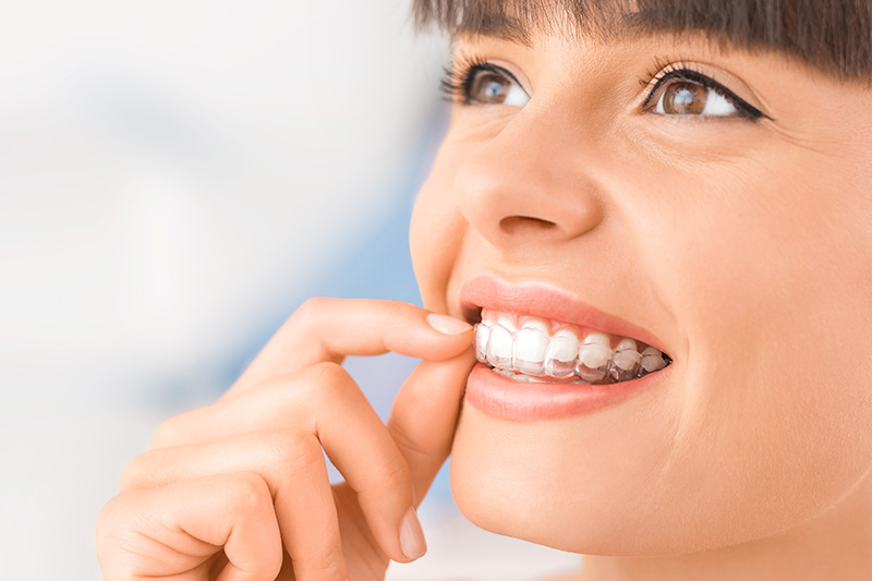 Dental Treatments in Fullerton