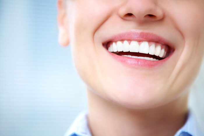How Do You Keep Teeth White?
