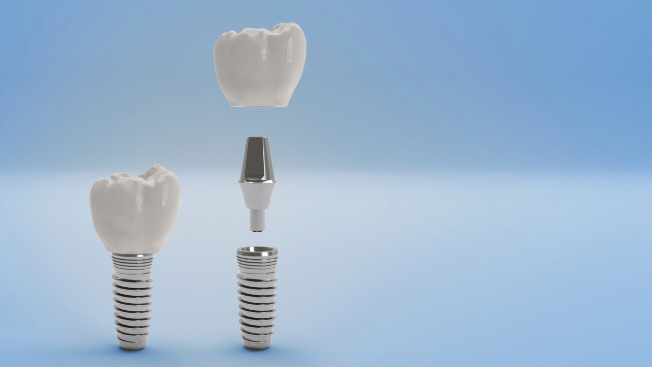 Is Dental Implant Treatment Painful?